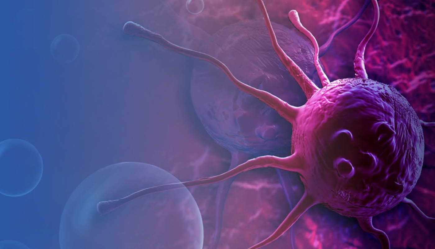 Urología Oncológica