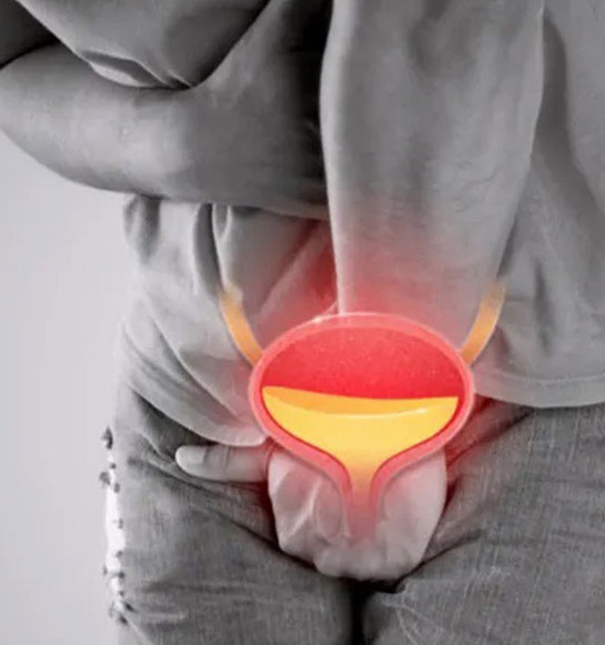 Infecciones Urinarias